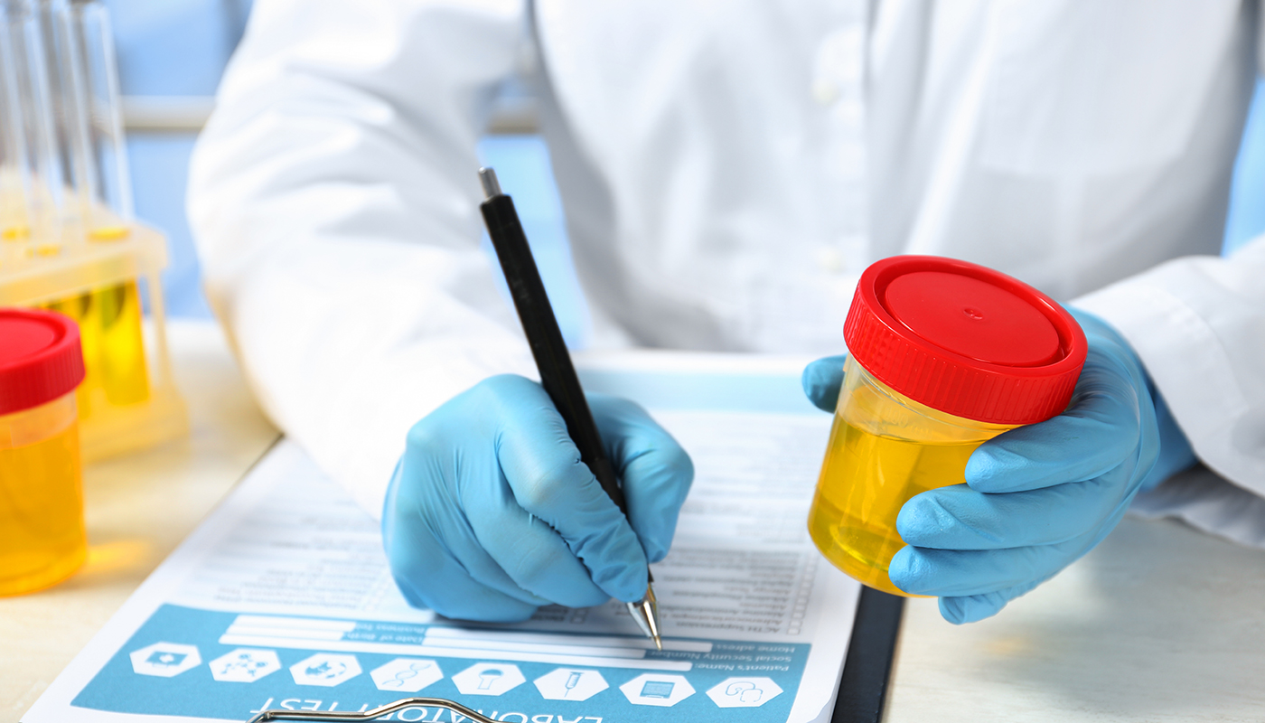 Urine testing is the most common method for gabapentin detection.