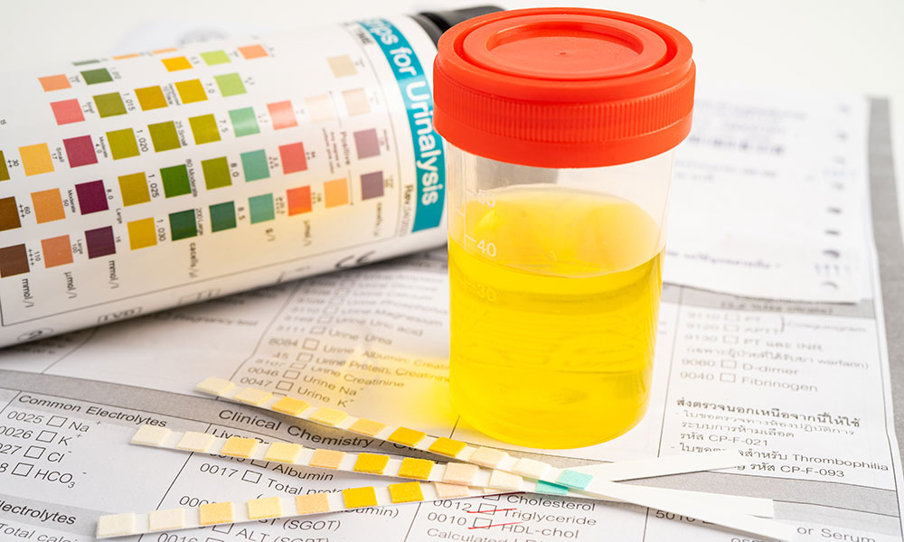 Urine tests usually have a longer detection window