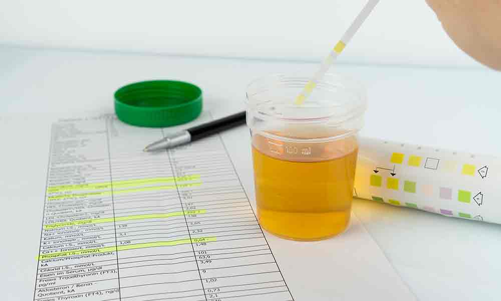Urine testing is the type of testing used most often in drug screenings